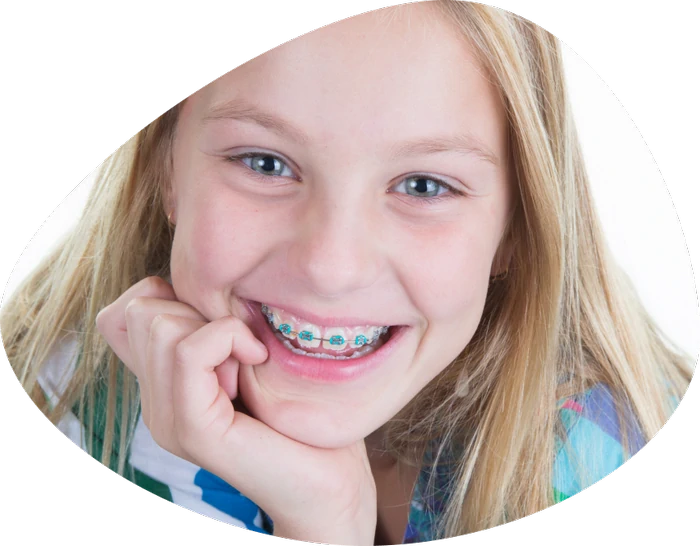 Aparat dentar